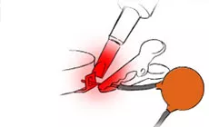 Utilisation d’un dissipateur thermique