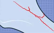 Diagramme du manche fissuré